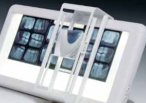 DENTSPLY RINN - Rinn X-Ray Viewer With Magnifier . Code : 67 - 0442